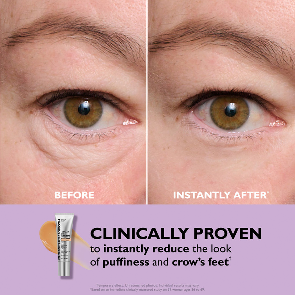 Instant Eye Tightener – Nouvelle Formule