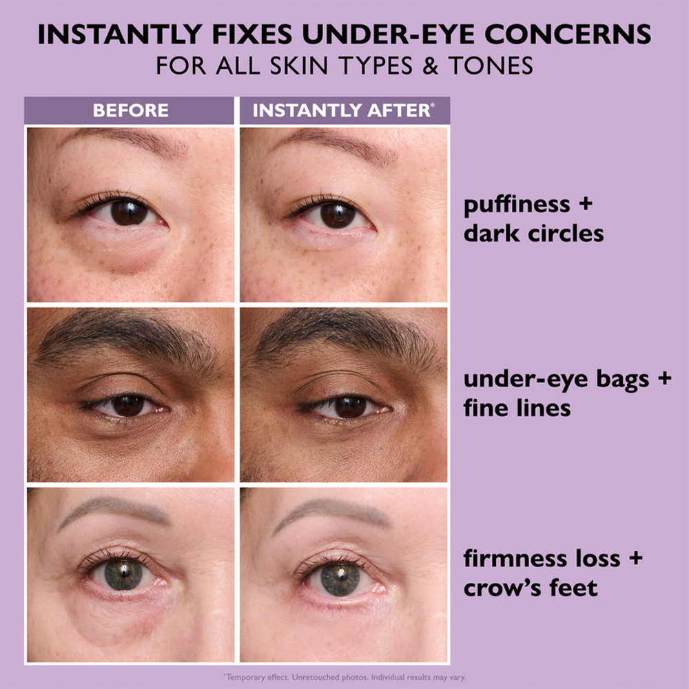 Instant Eye Tightener – Nouvelle Formule