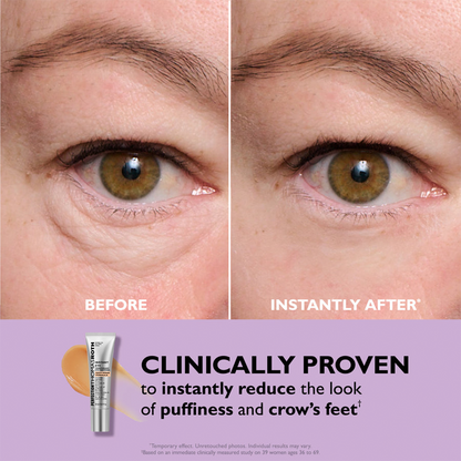 Instant Eye Tightener – Nouvelle Formule